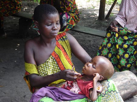 "bambino a uno stadio avanzato di denutrizione", centro nutrizionale, Djuma