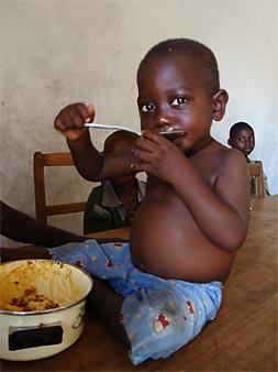 "Salomon sta migliorando anche se la sua pancia è ancora gonfia", centro nutrizionale, Kikwit